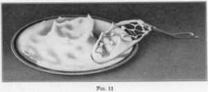 [Illustration: FIG. 11]